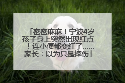 密密麻麻！宁波4岁孩子身上突然出现红点！连小便都变红了……家长：以为只是摔伤